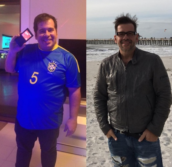 Antes e depois: Antes da cirurgia, o humorista pesou 150 kg