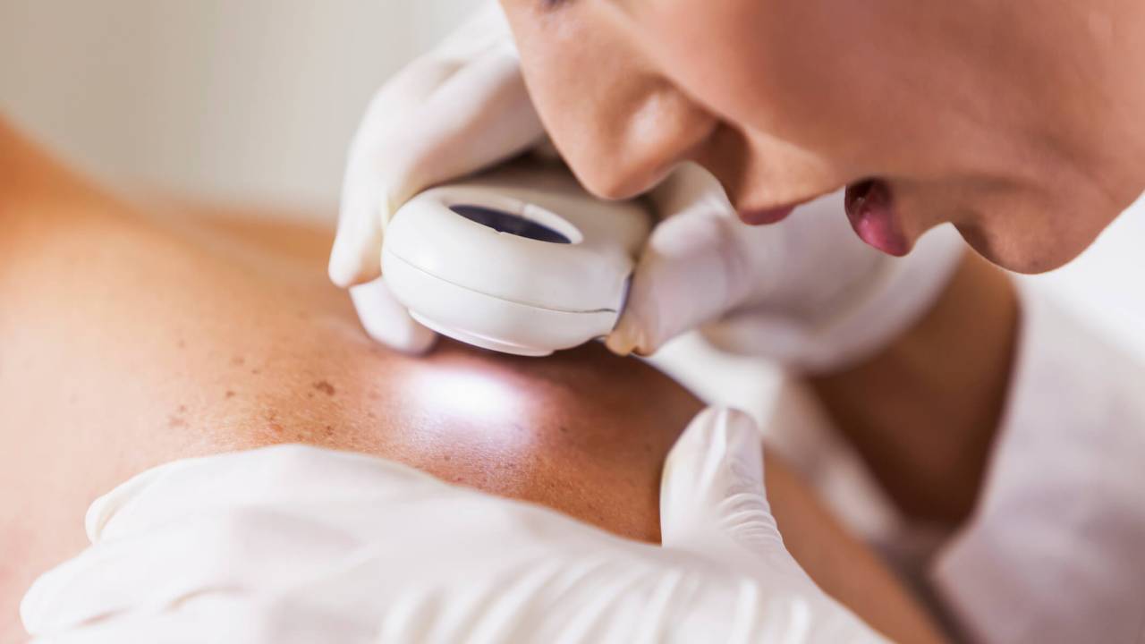 Médico examina pinta na pele de paciente