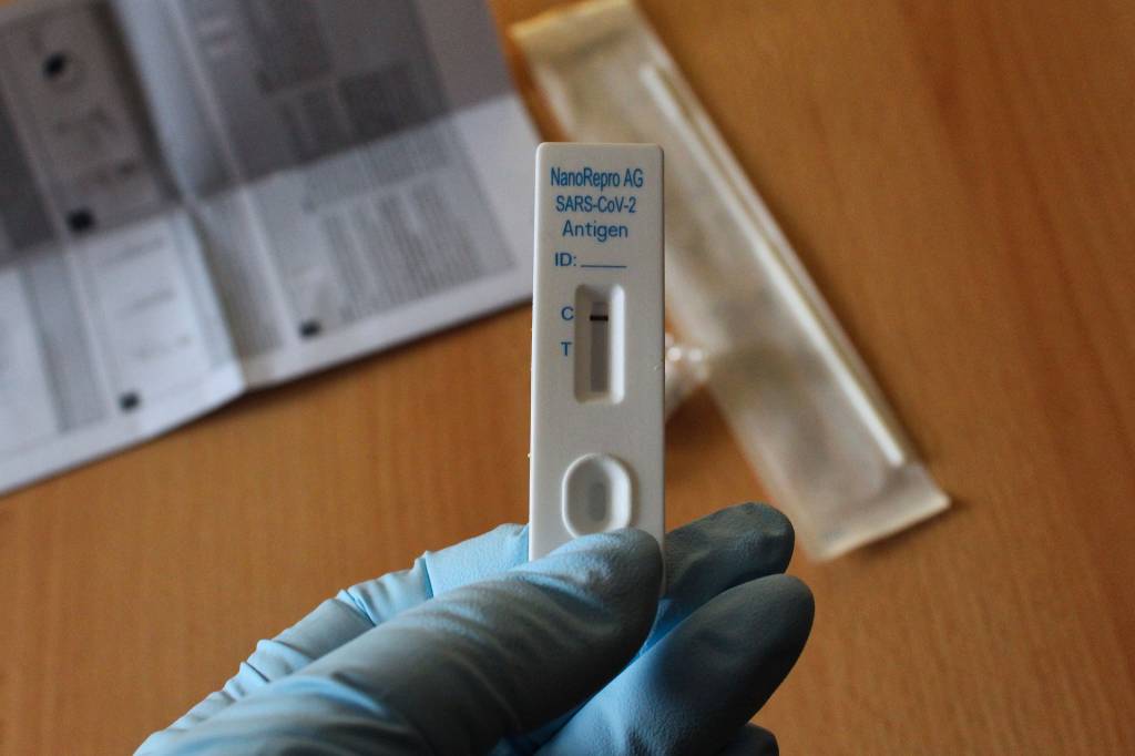 Foto mostra teste de antígeno negativo de Covid-19