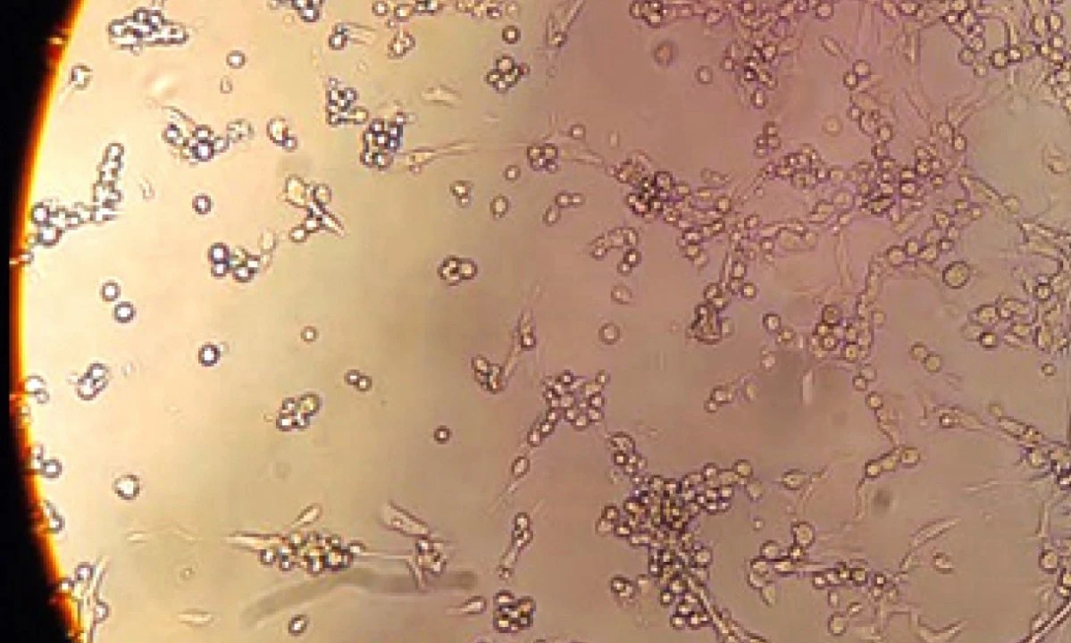 Fiocruz isola o vírus monkeypox e registra em imagens sua estrutura detalhada