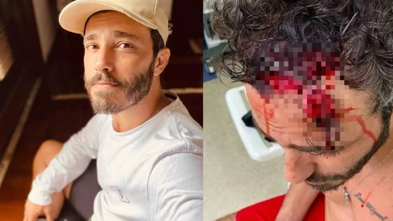 Fotos mostram o ator Thiago Rodrigues bem e após ser atacado