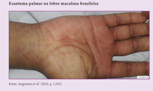 https://www.gov.br/saude/pt-br/centrais-de-conteudo/publicacoes/svsa/febre-maculosa/febre-maculosa-aspactos-epidemiologicos-clinicos-e-ambientais.pdf