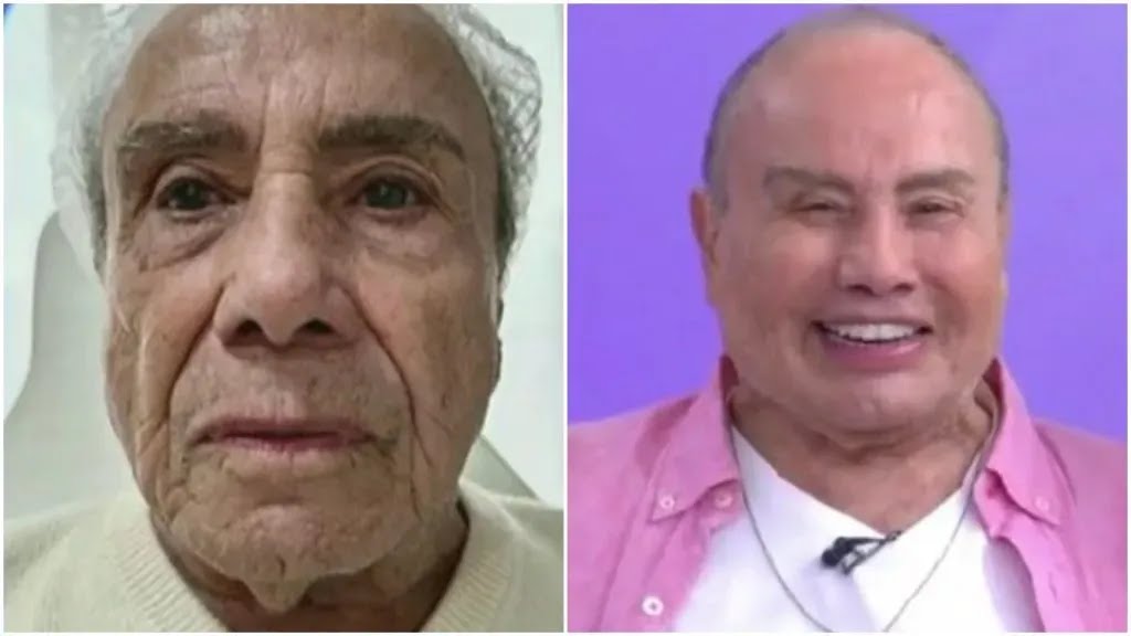 Foto mostra antes e depois do ator Stenio Garcia, que fez harmonização facial