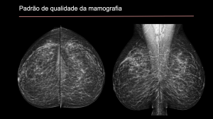 padrao qualidade mamografia. INCA 2023