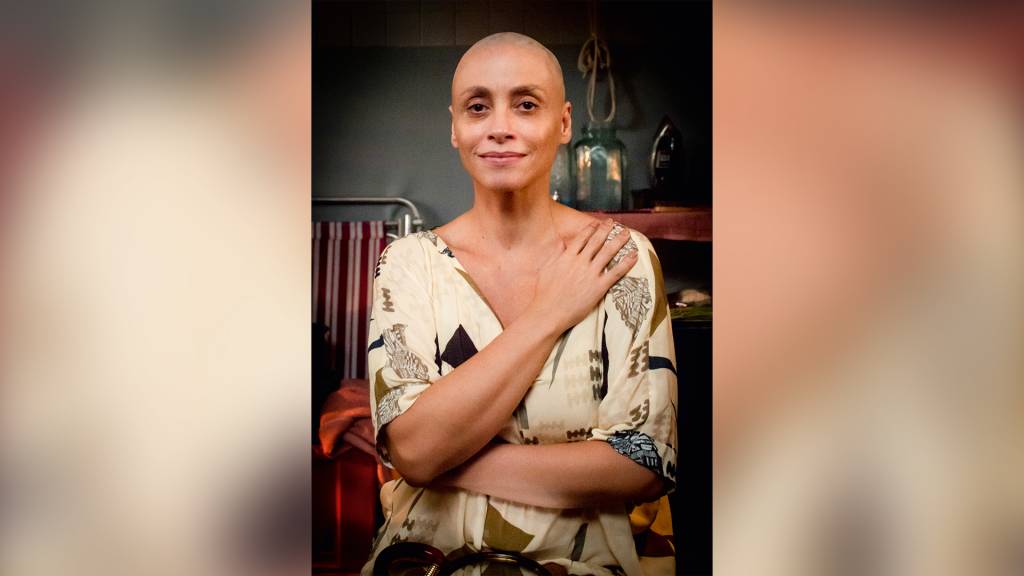 Desapego feminino: Suzana Pires raspa a cabeça por personagem com câncer