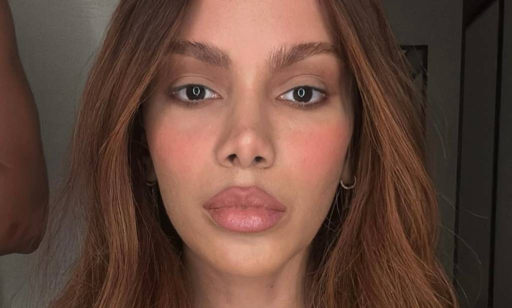 Anitta quebra silêncio e fala sobre procedimentos no rosto