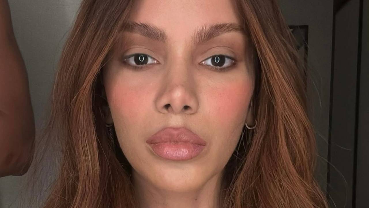 Procedimentos no rosto de Anitta