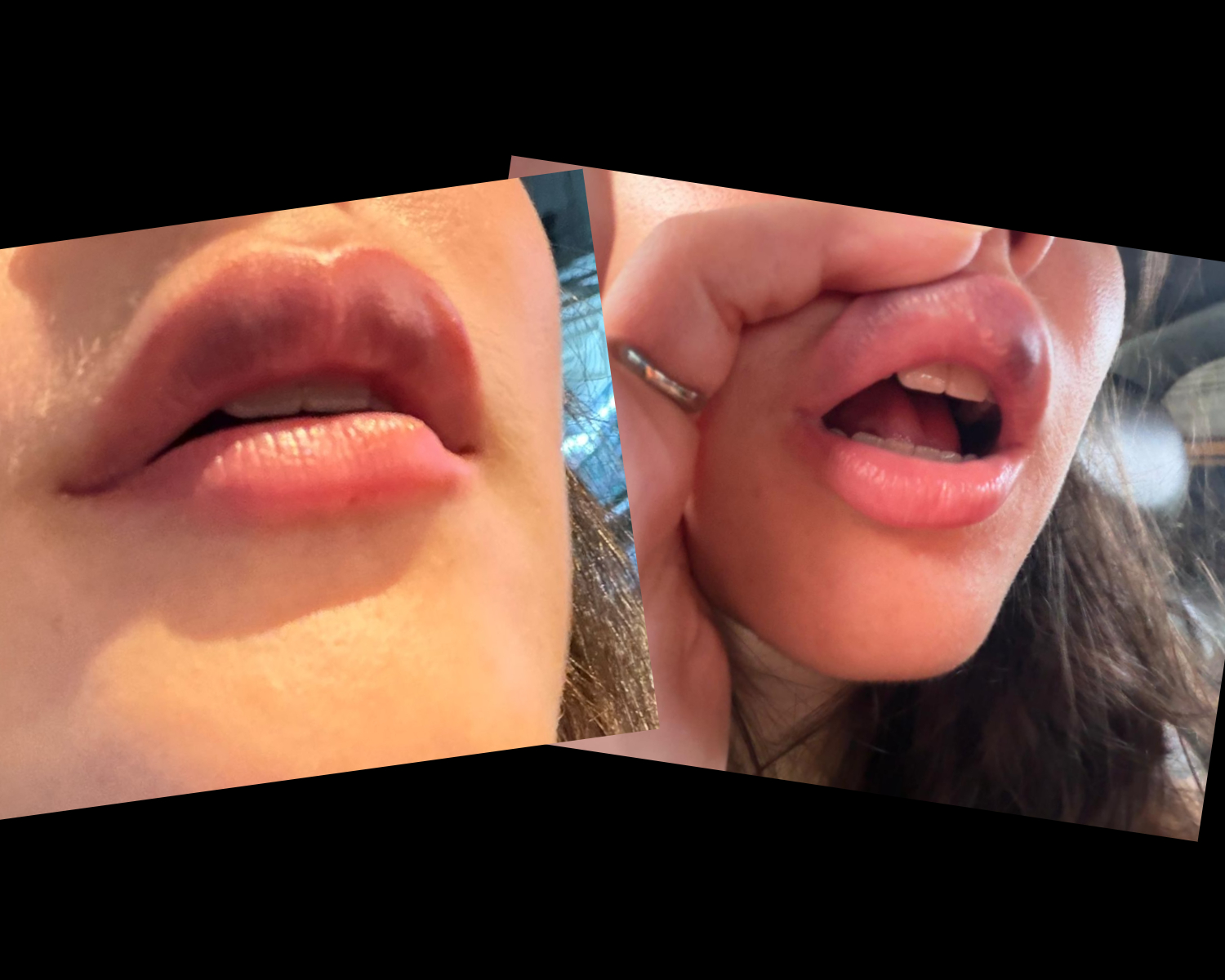 A boca beijada de A.C. depois de um encontro "caliente" de fim de semana